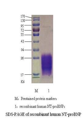 氨基末端脑钠肽前体 （NT-proBNP）(图2)