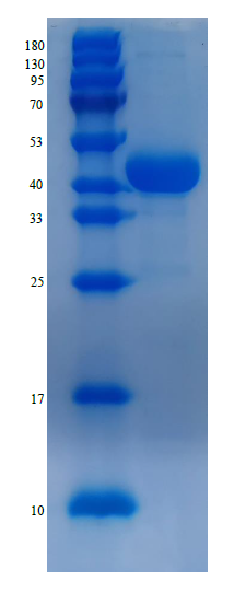 肌酸激酶（Creatine Kinase，CK 或Creatine Kinase,muscle，CKM ）(图1)