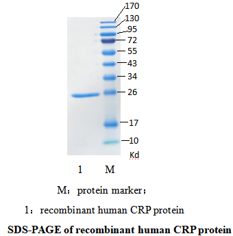 重组人C反应蛋白(图1) 重组人C反应蛋白(图1)